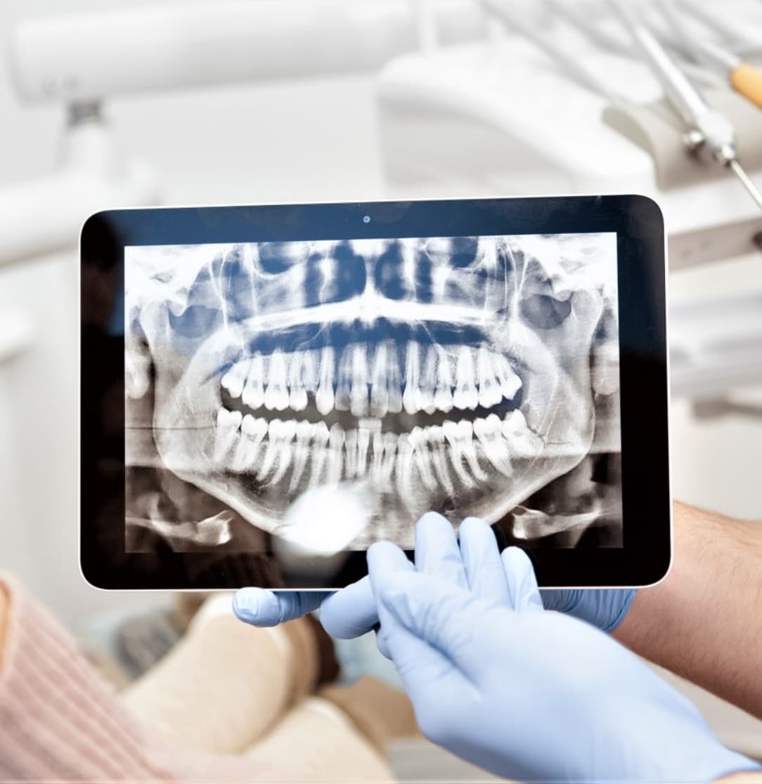 X-rays
